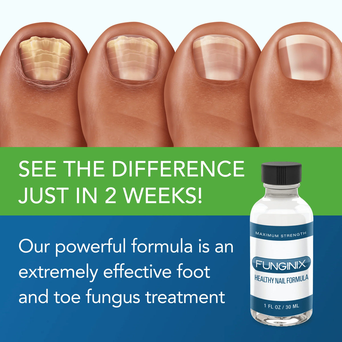 Anti-Fungal Nail Formula 1 fl oz A13661