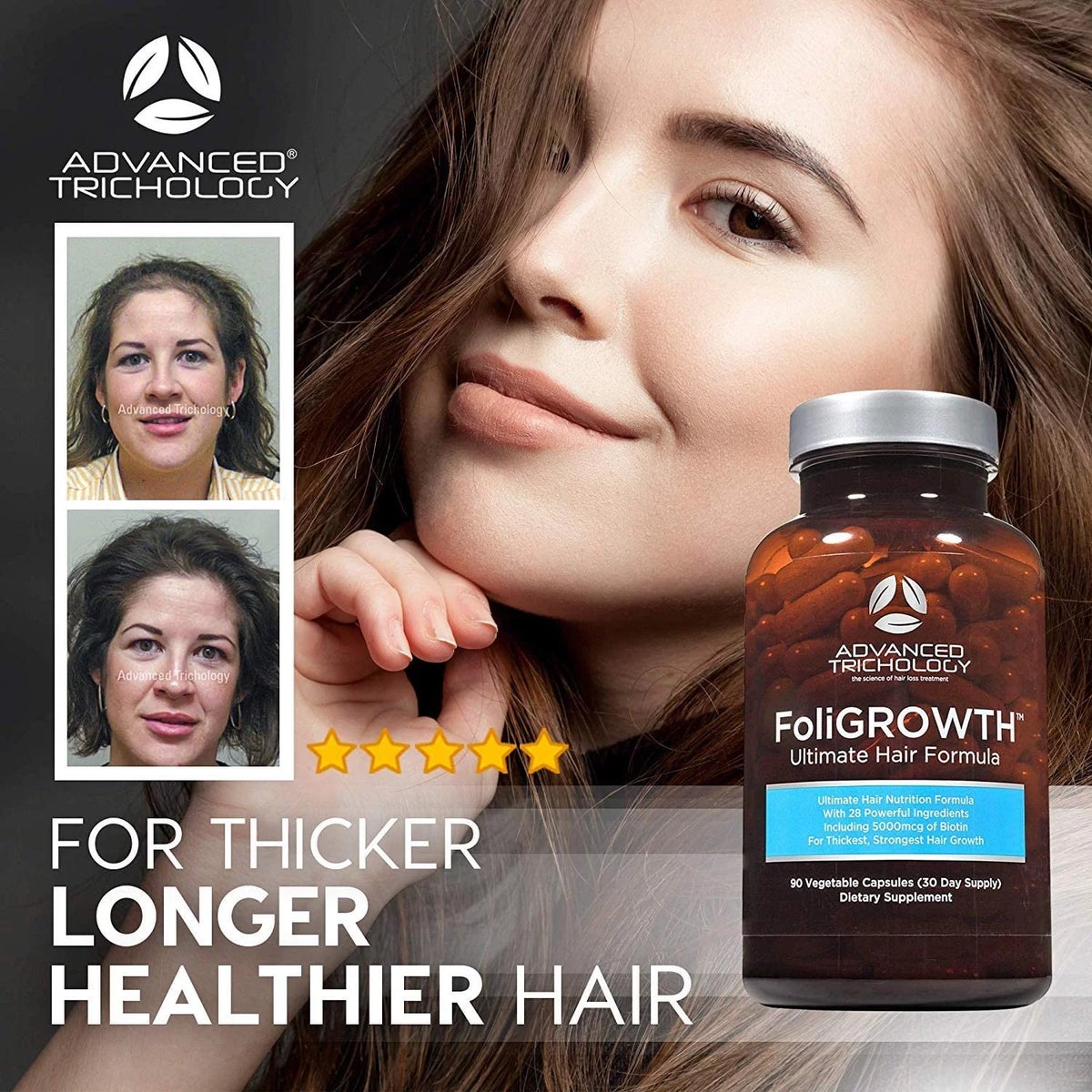 Hair Growth Vitamin with High Potency Biotin L8838